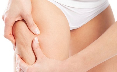 lifting cuisses tunisie
