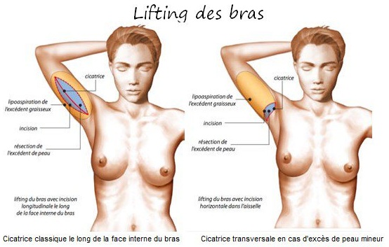lifting bras tunisie