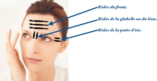 lifting frontal Tunisie