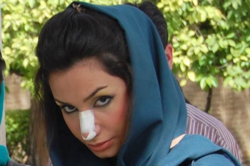 la rhinoplastie en iran