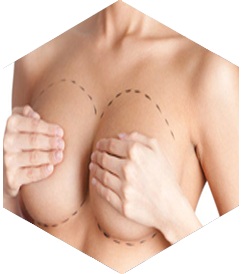 Prix Chirurgie Esthétique des seins