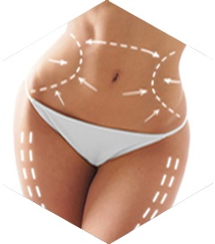Prix Chirurgie Esthetique de la silhouette