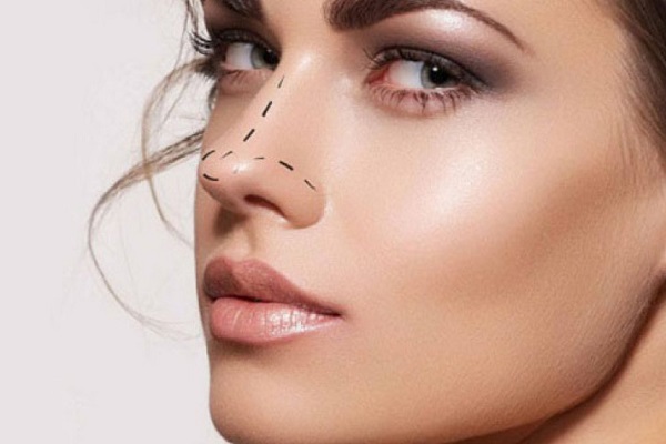chirurgie esthétique nez Tunisie