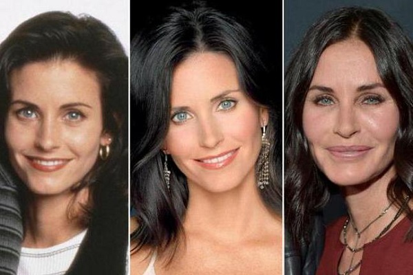 Courtney Cox chirurgie esthétique