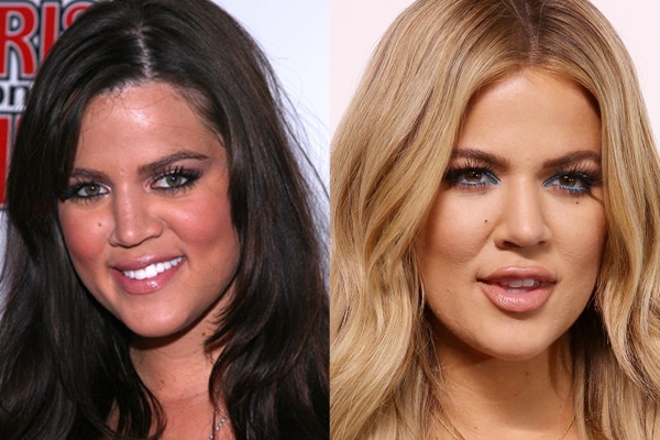 khloe kardashian chirurgie esthétique avant apres