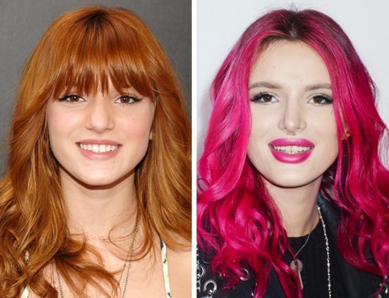 Bella Thorne et la chirurgie esthétique