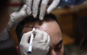 Tarif chirurgie esthétique Turquie